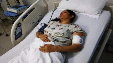 महिला पर पिटबुल ने किया हमला