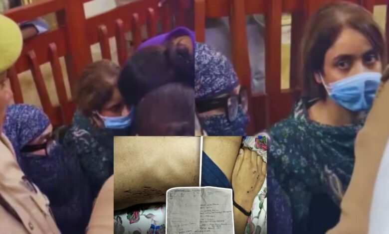 हाथ-पैरों पर सिगरेट से जलाए जाने के निशान